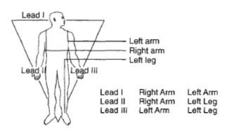 DIY Heart Monitoring Device (Simple ECG)