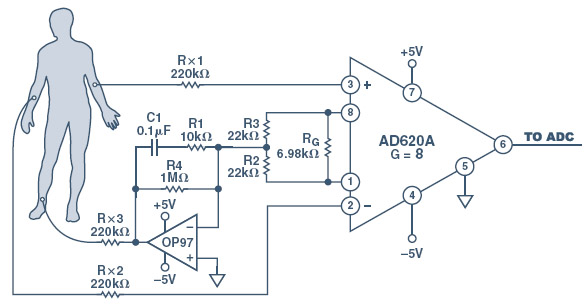 ECG Schematic