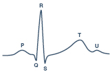 ECG Signal