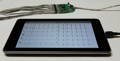 MobileECG may be next great open hardware project