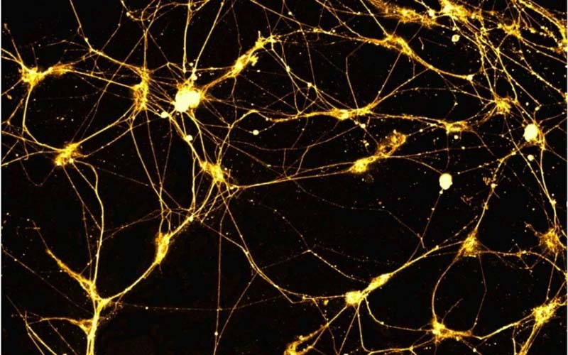 Физики Университета Лобачевского смоделировали сверхпроводниковый нейрон